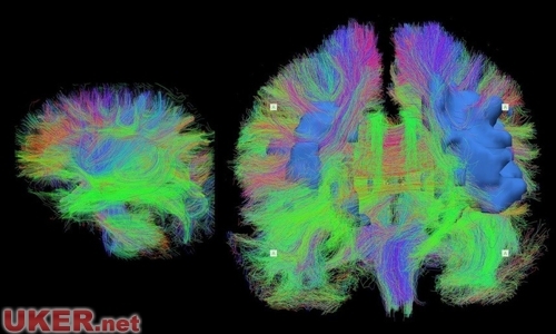 ������Ʒ���ͣ�Ӣ����Ƭչ��������֮����ͼ��